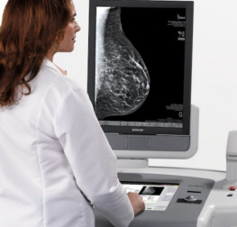 Raccomandazioni per la mammografia risonanza magnetica protesi dentarie