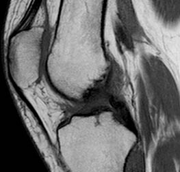 RM ginocchio 2 RM ginocchio 2