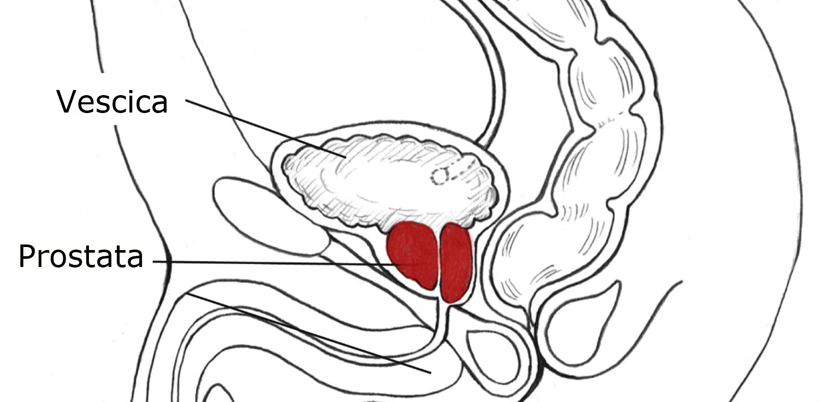 RM Prostata multiparametrica 1 RM Prostata multiparametrica 1