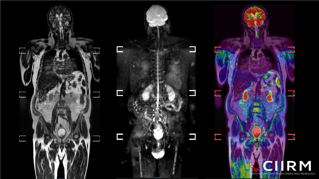 RM Encefalo 4 RM Encefalo 4