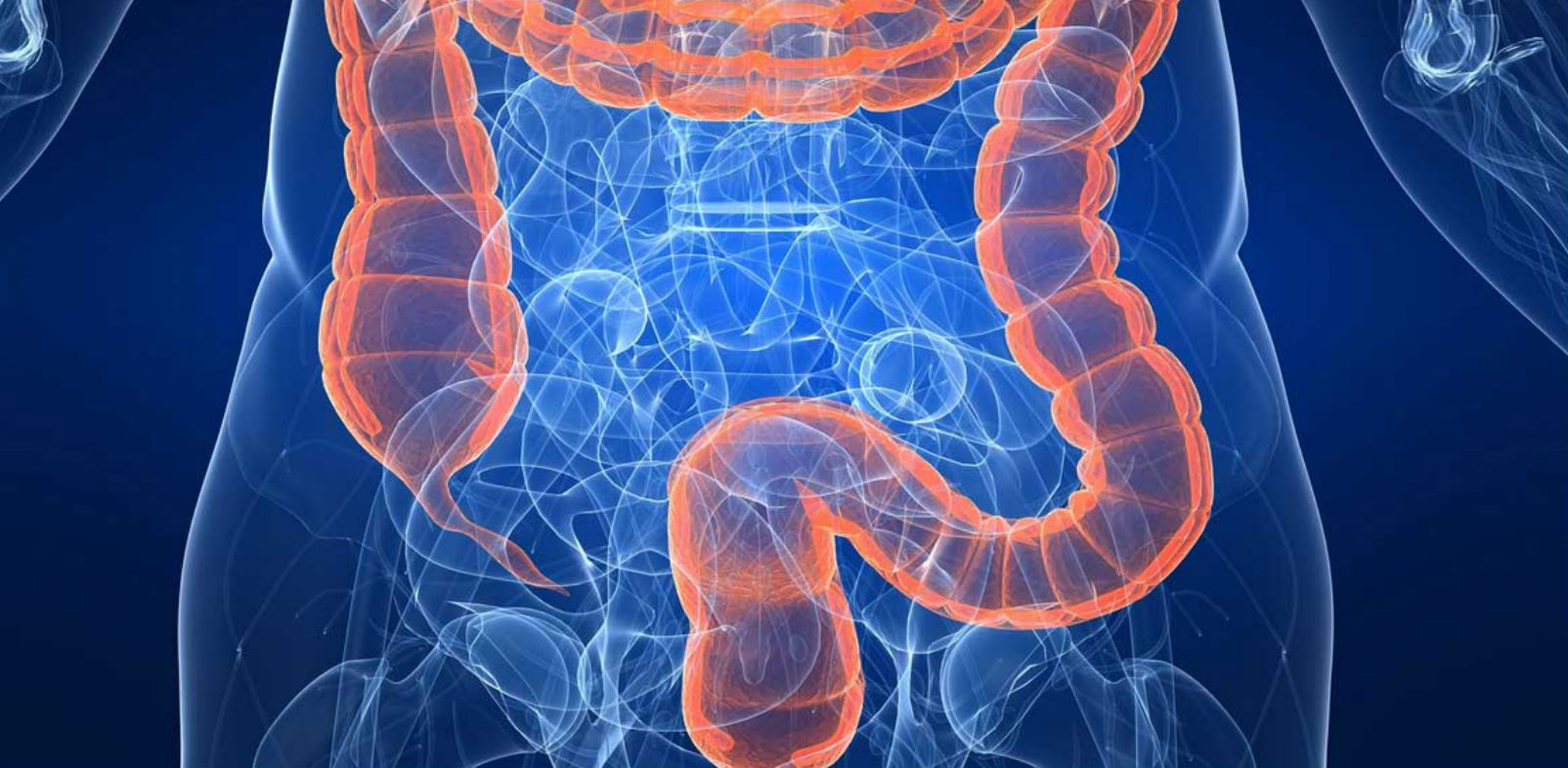 Colonscopia Virtuale 2 2 Mielo TC 2