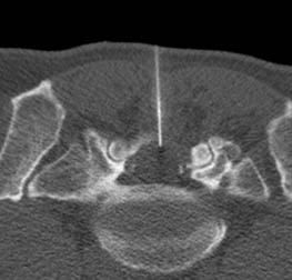 Mielo TC 2 Mielo TC 2